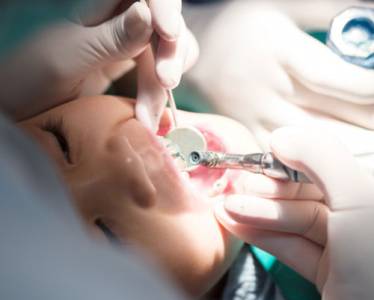 Root Canal Treatment