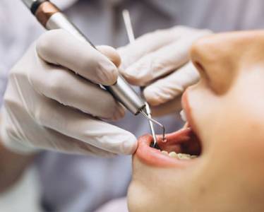 Orthodontic Treatment