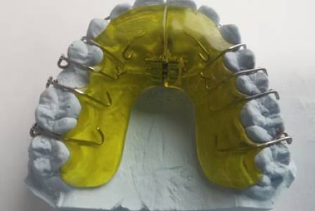 Orthodontic Treatment