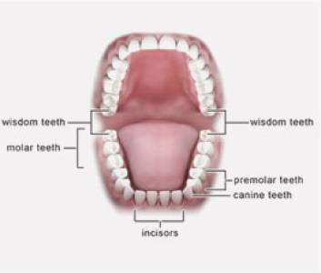 Wisdom Tooth Extraction