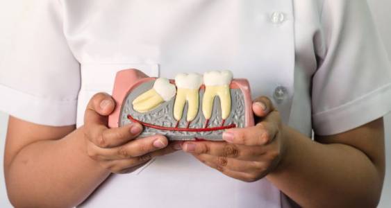 Wisdom Tooth Removal in Chandigarh