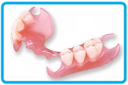 MISSING TEETH REPLACEMENT