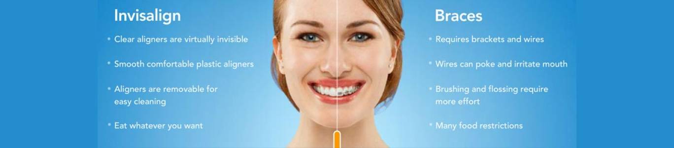 Invisalign Orthodontic Treatment