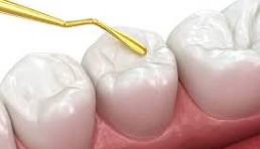 Restorative Dentistry