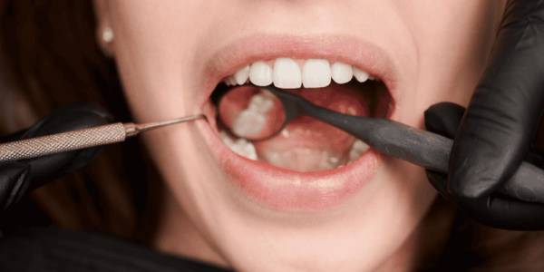 Full Mouth Construction