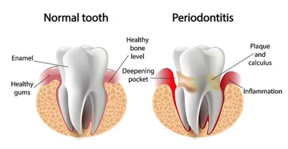 normal tooth