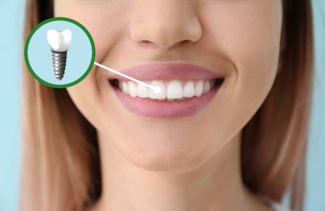 Cosmetic Dentistry