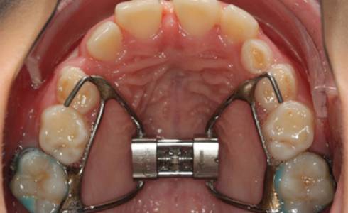 Oral Maxillofacial Surgery