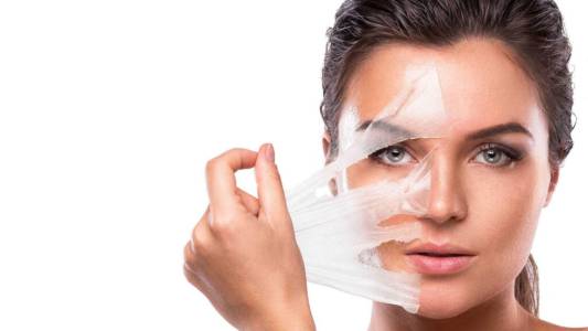 Chemical Peels
