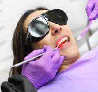 Dental Lasers