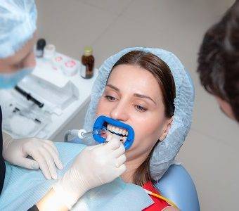 Dental Bonding in Bangalore