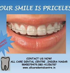 Dental Braces in Bangalore