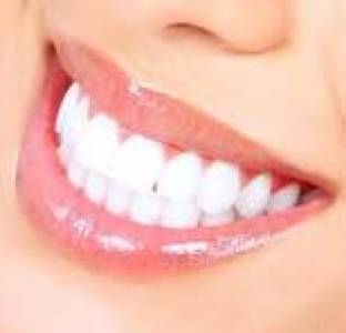 Teeth whitening