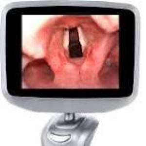 Video Laryngoscopy