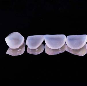 Dental Veneers