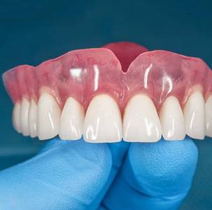 Dentures
