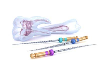 Root Canal Treatment