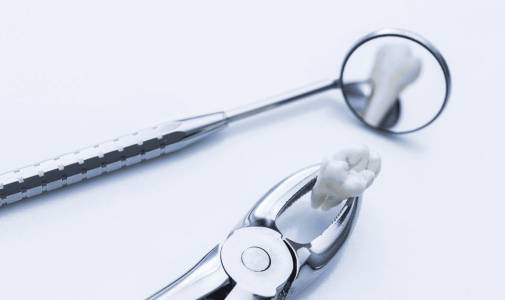 Wisdom Tooth Removal and Other Tooth Extractions