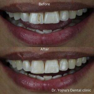 Conservative Dentistry