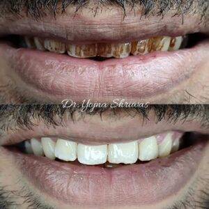 Preventive Dentistry