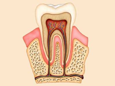 Root Canal Treatment (RCT)