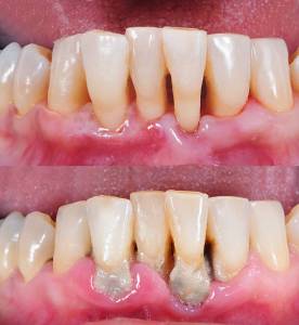 Cleaning & Prevention