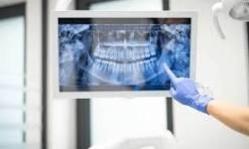 Dental Radiology