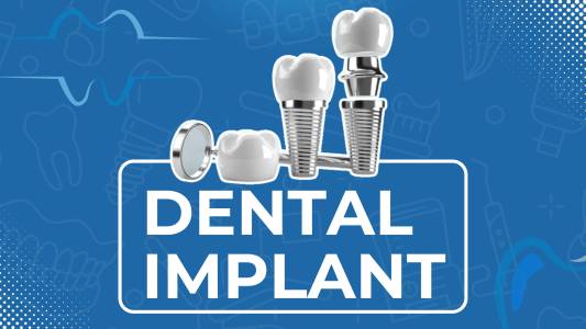 Dental Implant
