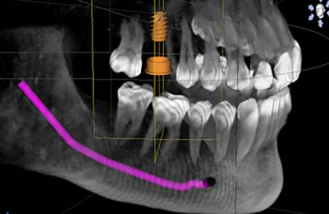 3-D X-rays / Imaging