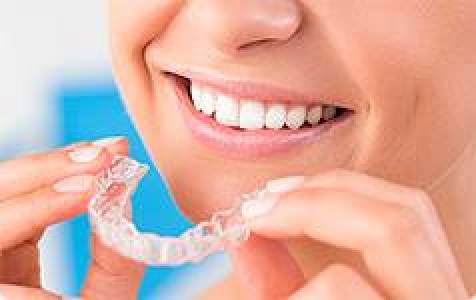 Braces & Aligners