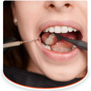 Wisdom Teeth Removal