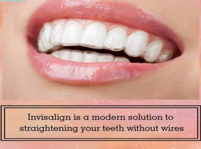 Invisalign invisible braces