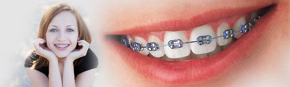orthodontic