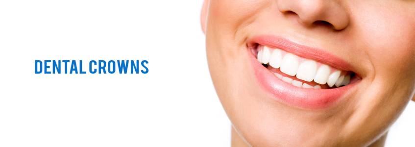 Dental Crowns