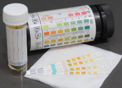 URINE CHEMISTRY